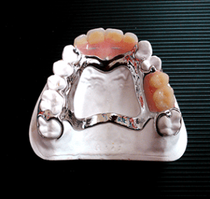 Chrome dentures