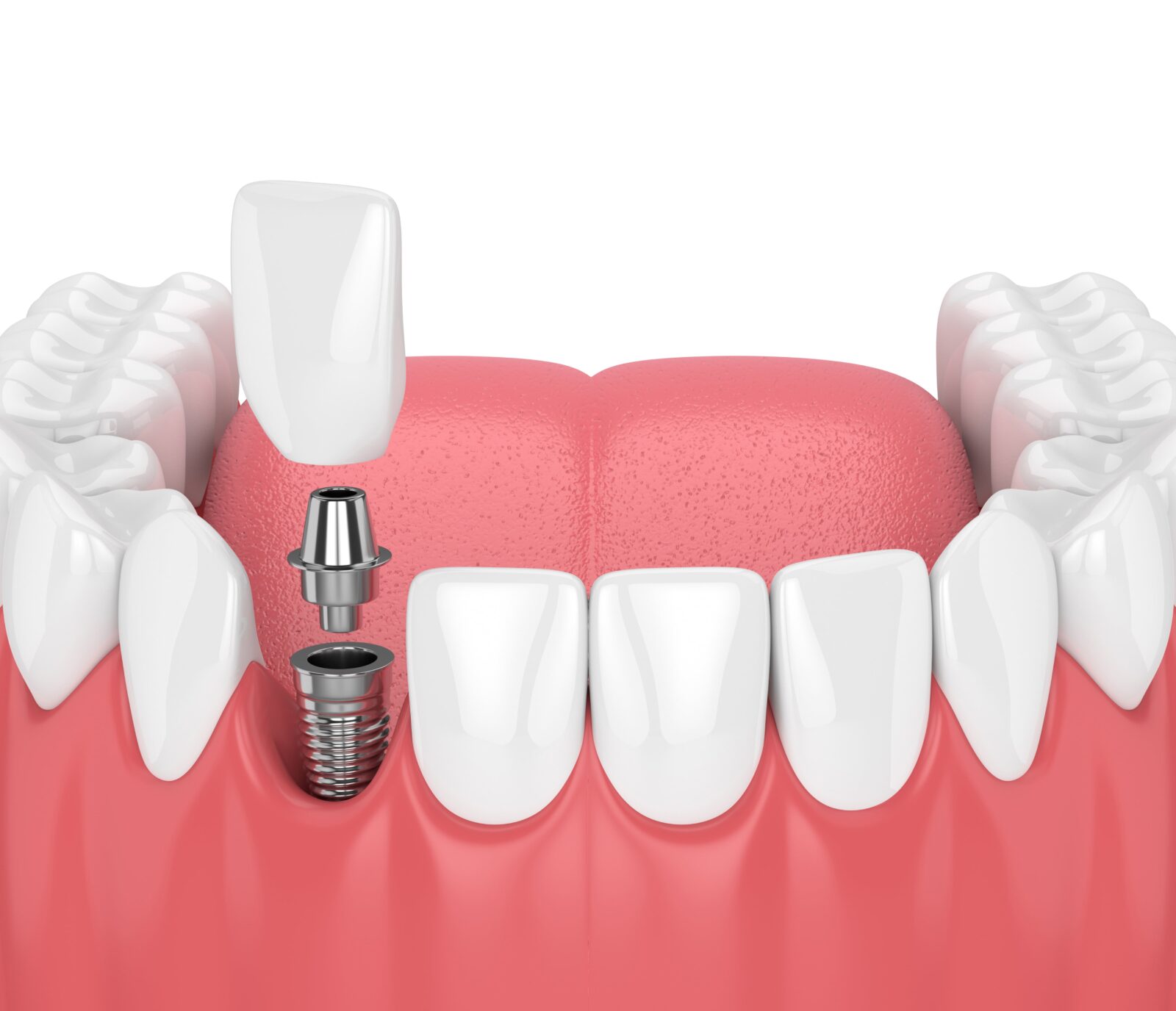 HQ Dental - Decorative Image